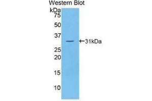 Detection of Recombinant Thyroglobulin, Human using Polyclonal Antibody to Thyroglobulin (TG)