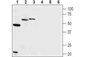 Western blot analysis of rat pancreas membrane (lanes 1 and 4), rat hippocampus (lanes 2 and 5) and mouse pancreatic cancer cell line (MS1) (lanes 3 and 6):1-3. (Presenilin 1 (PSEN1) Peptide)