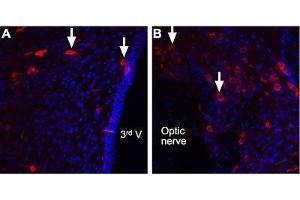Expression of Angiotensin II receptor type-2 in rat brain - Immunohistochemical staining of rat brain sections using Anti-Angiotensin Receptor Type-2 (extracellular) Antibody (ABIN7042925, ABIN7043902 and ABIN7043903).