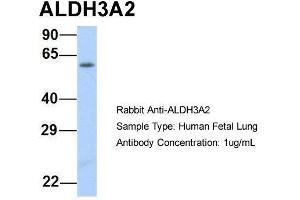 Host:  Rabbit  Target Name:  ALDH3A2  Sample Type:  Human Fetal Lung  Antibody Dilution:  1. (ALDH3A2 anticorps  (Middle Region))