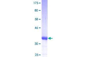 Image no. 1 for S100 Calcium Binding Protein A10 (S100A10) (AA 1-97) protein (GST tag) (ABIN1319041)