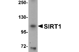 Western Blotting (WB) image for anti-Sirtuin 1 (SIRT1) (N-Term) antibody (ABIN1031567) (SIRT1 anticorps  (N-Term))