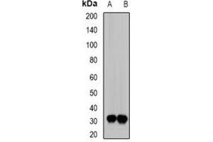 Western blot analysis of SIAH1 expression in BT474 (A), mouse kidney (B) whole cell lysates.
