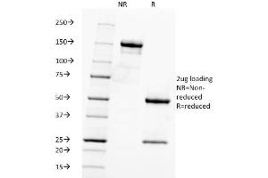 SDS-PAGE Analysis Purified Fascin-1 Mouse Monoclonal Antibody (FSCN1/416).