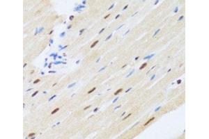 Immunohistochemistry of paraffin-embedded Rat heart using MTA3 Polyclonal Antibody at dilution of 1:100 (40x lens). (MTA3 anticorps)
