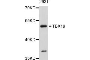 Western blot analysis of extracts of 293T cells, using TBX19 antibody (ABIN4905379) at 1:1000 dilution.