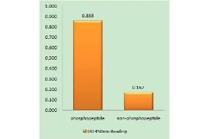Immunohistochemistry analysis of paraffin-embedded human brain tissue using EPHA3/4/5 (Phospho-Tyr779/833) antibody. (EPH Receptor A3 anticorps  (pTyr779, pTyr833))