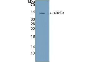 Detection of Recombinant ALPL, Human using Polyclonal Antibody to Alkaline Phosphatase, Tissue-nonspecific (ALPL)