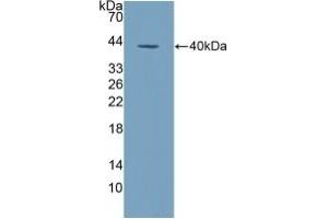 Detection of Recombinant ALPL, Human using Polyclonal Antibody to Alkaline Phosphatase, Tissue-nonspecific (ALPL) (ALPL anticorps  (AA 18-335))