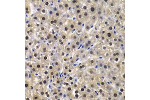 Immunohistochemistry of paraffin-embedded rat liver using KPNA4 Antibody (ABIN5971058) at dilution of 1/100 (40x lens). (KPNA4 anticorps)