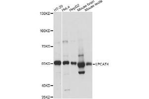 Western blot analysis of extracts of various cell lines, using LPCAT4 antibody (ABIN6292470) at 1:3000 dilution. (LPCAT4 anticorps)