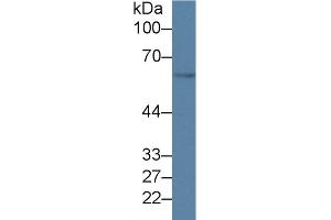 Detection of GDF5 in Mouse Cerebrum lysate using Polyclonal Antibody to Growth Differentiation Factor 5 (GDF5)