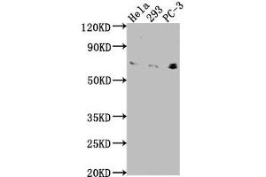 Western Blot Positive WB detected in: Hela whole cell lysate, 293 whole cell lysate, PC-3 whole cell lysate All lanes: EXOC7 antibody at 1:2000 Secondary Goat polyclonal to rabbit IgG at 1/50000 dilution Predicted band size: 84, 79, 75, 33, 78, 81 kDa Observed band size: 75 kDa (EXOC7 anticorps  (AA 521-735))