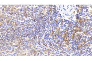 Detection of HLA-DRA in Rabbit Spleen Tissue using Polyclonal Antibody to HLA Class II Histocompatibility Antigen, DR Alpha Chain (HLA-DRA) (HLA-DRA anticorps  (AA 26-221))