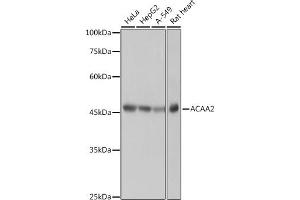Western blot analysis of extracts of various cell lines, using  antibody (ABIN7265367) at 1:1000 dilution. (ACAA2 anticorps)