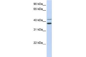 WB Suggested Anti-MKRN2 Antibody Titration:  0. (MKRN2 anticorps  (N-Term))