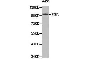 Western Blotting (WB) image for anti-Progesterone Receptor (PGR) antibody (ABIN1874114) (Progesterone Receptor anticorps)