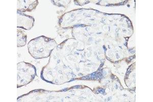Immunohistochemistry of paraffin-embedded Human placenta using CLUH Polyclonal Antibody at dilution of 1:100 (40x lens). (CLUH anticorps)