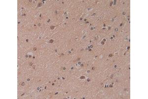 Used in DAB staining on fromalin fixed paraffin- embedded brain tissue (CBY1/PGEA1 anticorps  (AA 12-115))