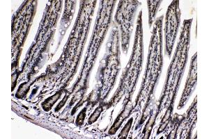 IHC analysis of Cyclophilin A using anti- Cyclophilin A antibody .