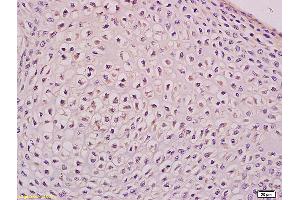 Formalin-fixed and paraffin embedded mouse embryo tissue labeled with Anti Apg12 Polyclonal Antibody,Unconjugated (ABIN752518) at 1:200 followed by conjugation to the secondary antibody and DAB staining.