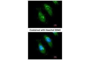 ICC/IF Image Immunofluorescence analysis of methanol-fixed HeLa, using SMN1, antibody at 1:200 dilution. (SMN1 anticorps)