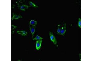 Immunofluorescent analysis of Hela cells using ABIN7171480 at dilution of 1:100 and Alexa Fluor 488-congugated AffiniPure Goat Anti-Rabbit IgG(H+L)