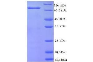 SDS-PAGE (SDS) image for N-Deacetylase/N-Sulfotransferase (Heparan Glucosaminyl) 1 (NDST1) (AA 40-556), (Isoform 2) protein (His-SUMO Tag) (ABIN5709995)