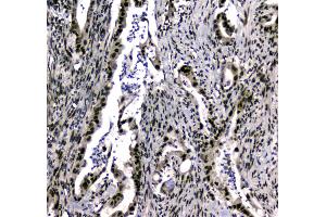 IHC analysis of SAE2/UBA2 using anti-SAE2/UBA2 antibody . (UBA2 anticorps  (AA 449-564))