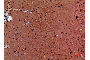 Immunohistochemistry (IHC) analysis of paraffin-embedded Mouse Brain, antibody was diluted at 1:100.