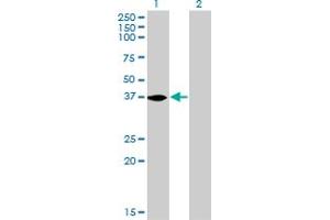 Western Blot analysis of NMI expression in transfected 293T cell line by NMI monoclonal antibody (M01), clone 9D8. (NMI anticorps  (AA 1-100))