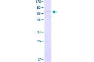 Image no. 1 for Proteasome (Prosome, Macropain) 26S Subunit, ATPase, 6 (PSMC6) (AA 1-389) protein (GST tag) (ABIN1316611)