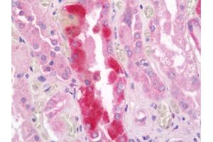 anti-Inositol Polyphosphate-5-Phosphatase, 40kDa (INPP5A) (AA 128-330) antibody