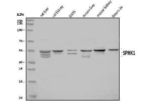 Western blot analysis of SPHK1 using anti-SPHK1 antibody (ABIN7600168).