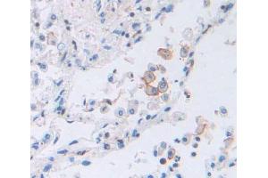 Used in DAB staining on fromalin fixed paraffin- embedded lung tissue