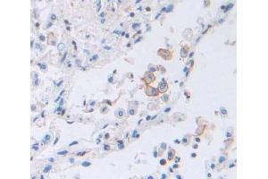Used in DAB staining on fromalin fixed paraffin- embedded lung tissue (TAP2 anticorps  (AA 468-686))