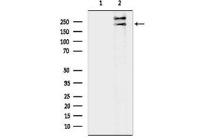 anti-Transcription Factor 20 (TCF20) antibody