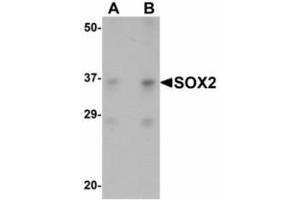 Image no. 1 for anti-SRY (Sex Determining Region Y)-Box 2 (SOX2) (N-Term) antibody (ABIN478109) (SOX2 anticorps  (N-Term))
