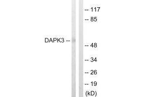 Western blot analysis of extracts from HuvEc cells, using DAPK3 (Ab-265) antibody.