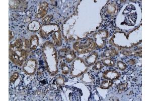 Formalin-fixed and paraffin embedded rat kidney labeled with Anti-Talin Polyclonal Antibody, Unconjugated (ABIN701695) followed by conjugation to the secondary antibody and DAB staining (TLN1 anticorps  (AA 1601-1750))