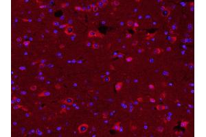 Paraformaldehyde-fixed, paraffin embedded Mouse brain; Antigen retrieval by boiling in sodium citrate buffer (pH6.