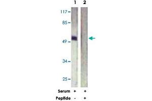 Western blot analysis of extracts from HeLa cells, treated with Serum (20 %, 15 mins), using ETS1 polyclonal antibody . (ETS1 anticorps)