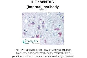 Image no. 2 for anti-Wingless-Type MMTV Integration Site Family, Member 8B (WNT8B) (Internal Region) antibody (ABIN1740842) (WNT8B anticorps  (Internal Region))