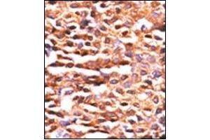 Image no. 2 for anti-Protein Phosphatase 2, Catalytic Subunit, alpha Isozyme (PPP2CA) (AA 1-30), (N-Term) antibody (ABIN360806)