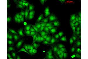 Immunocytochemistry/Immunofluorescence analysis using Rabbit Anti-HSP22 Polyclonal Antibody . (HSPB8 anticorps  (Atto 390))