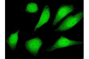 Immunofluorescence of monoclonal antibody to SIRT2 on HeLa cell.