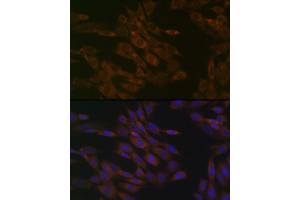 Immunofluorescence analysis of NIH-3T3 cells using TIMM50 Rabbit mAb (ABIN1513120, ABIN3022092, ABIN3022093 and ABIN7101443) at dilution of 1:100 (40x lens).