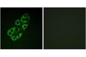 Immunofluorescence analysis of A549 cells, using MtSSB Antibody. (SSBP1 anticorps  (AA 99-148))