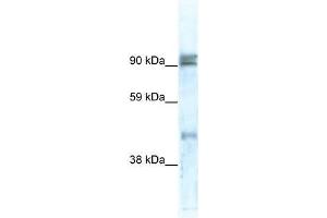 Western Blot showing ZNF227 antibody used at a concentration of 1-2 ug/ml to detect its target protein. (ZNF227 anticorps  (N-Term))