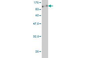 Western Blot detection against Immunogen (89. (CDKN2AIP anticorps  (AA 1-579))
